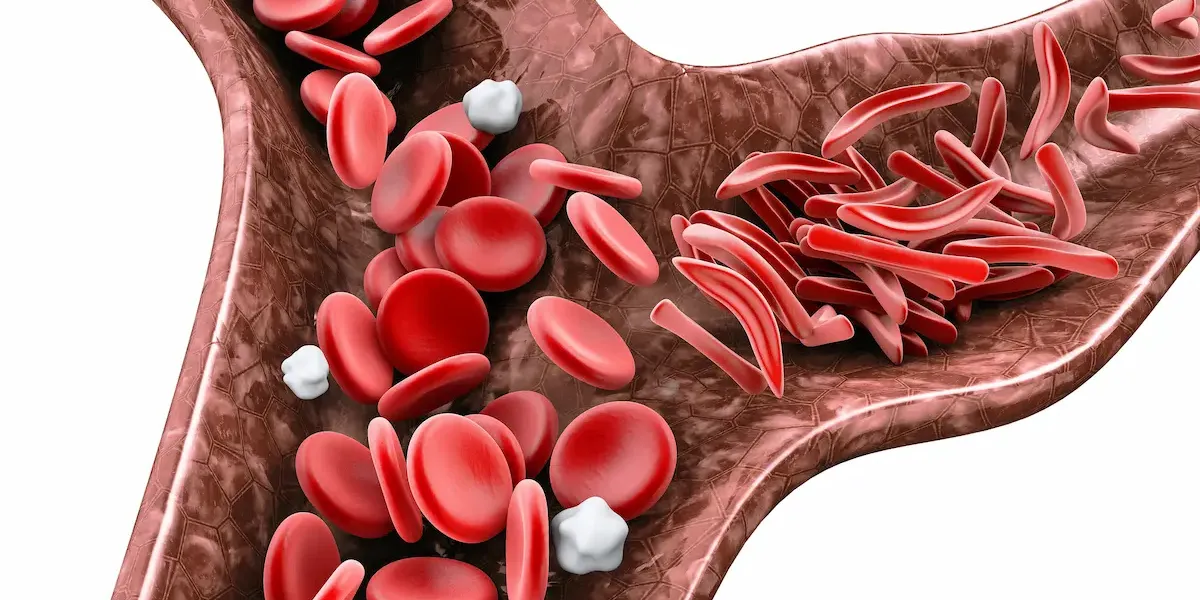 Anemia perniciosa (carencia de vitamina B12) :: Menú aconsejado